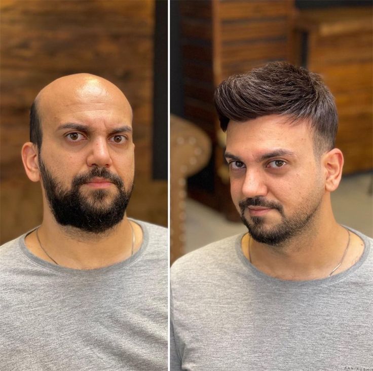 MENS SILK BASE WIG